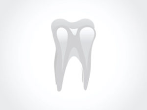 knocked out tooth Dover, OH